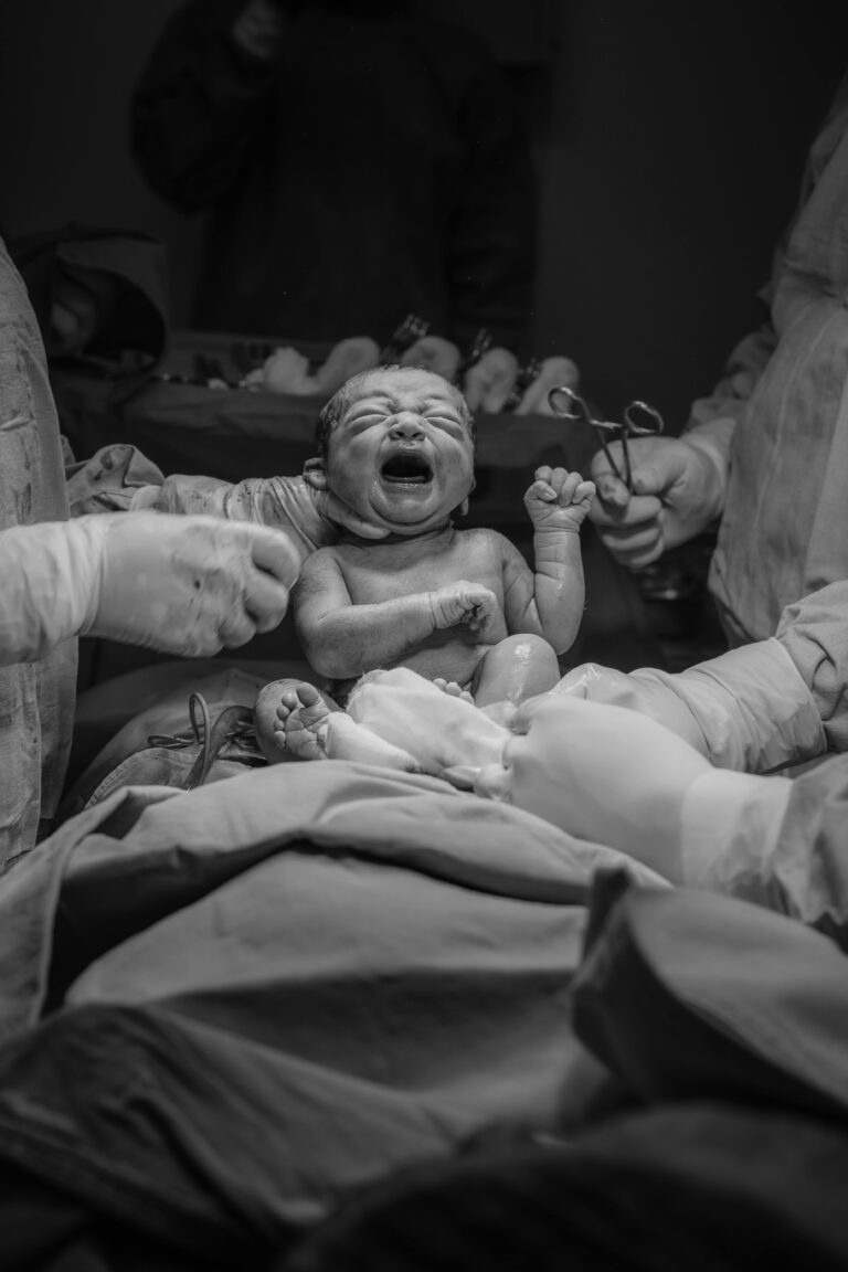 Vaginal Seeding: Long-Term Benefits for Babies Born by C-Section